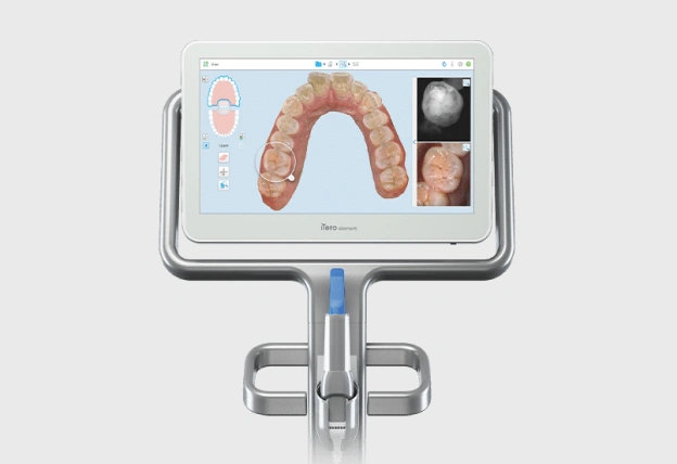 Img-itero-digital-scanning